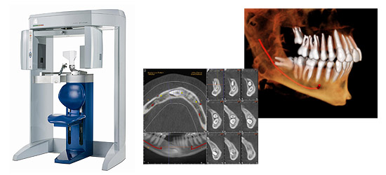coputed tomography
